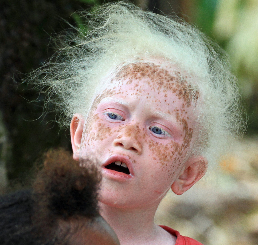 Charming choir member. Blondism/albinism exists here.